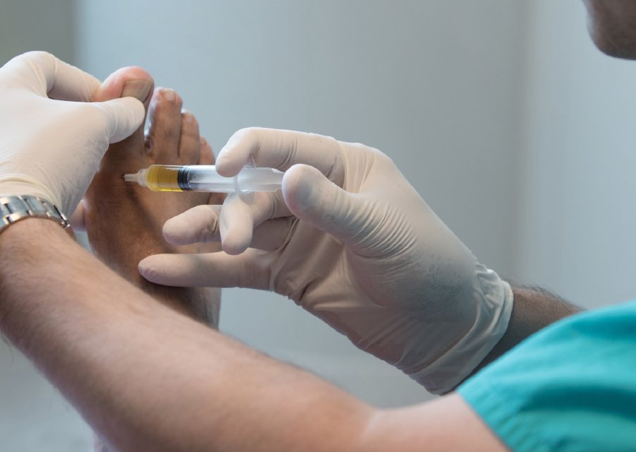 PRP Therapy