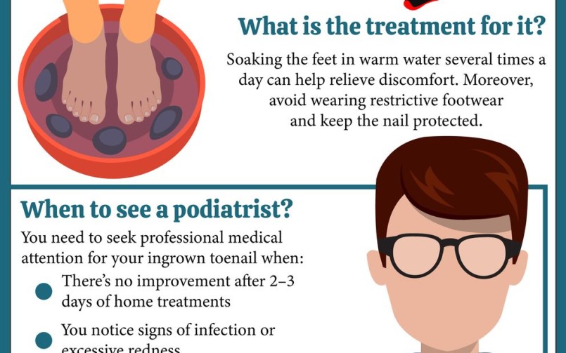ingrown toenails