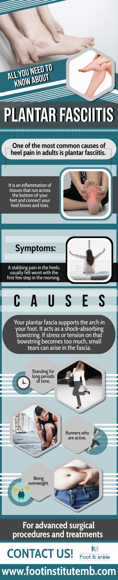 Plantar fasciitis: heel pain infographic.