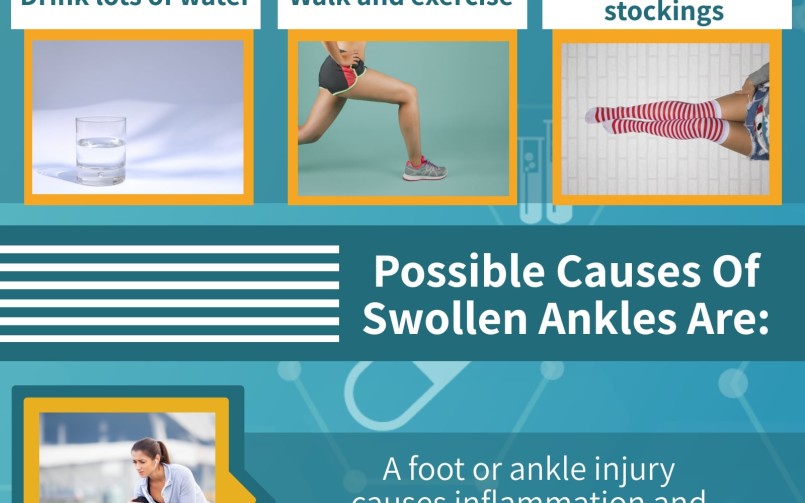 Swollen ankles