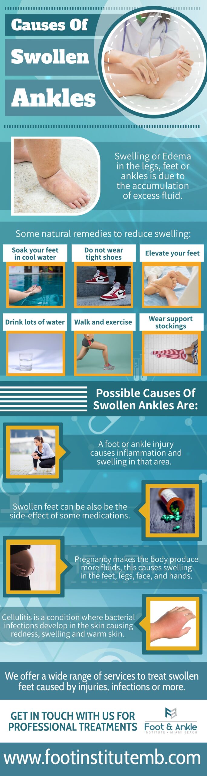 Causes and treatments for swollen ankles.