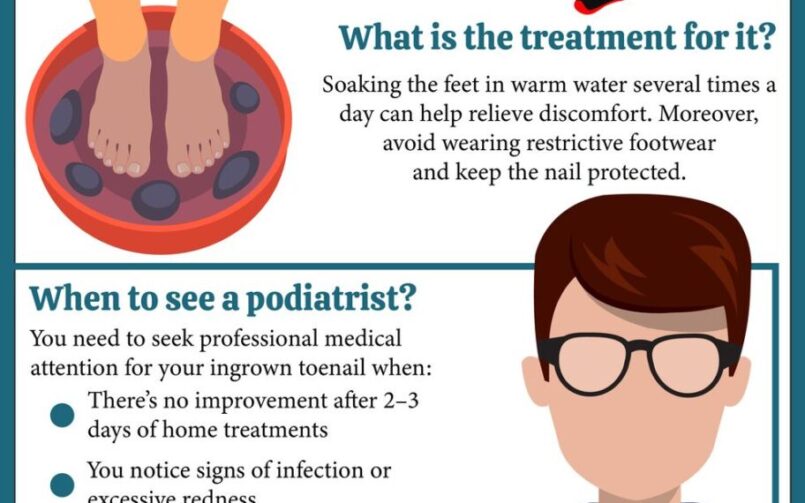 Ingrown toenail: causes, treatment, & podiatrist.